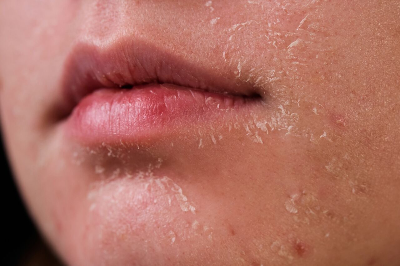 Уход за сухой кожей лица: главные правила и лучшие средства